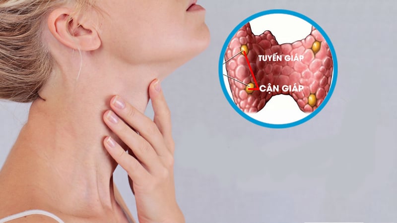 Tăng Canxi máu là một bệnh lý nguy hiểm nhưng dễ bị bỏ sót
