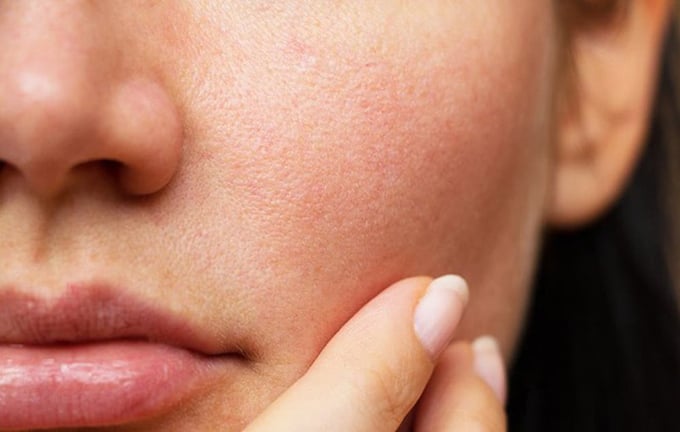 Suy giảm estrogen khiến da bắt đầu lão hóa (Ảnh minh họa)