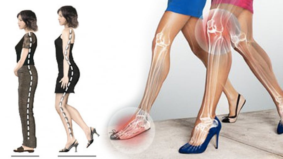 Đi giày cao gót khiến khớp gối và mắt cá chân phải chịu áp lực nặng nề (Ảnh minh họa)