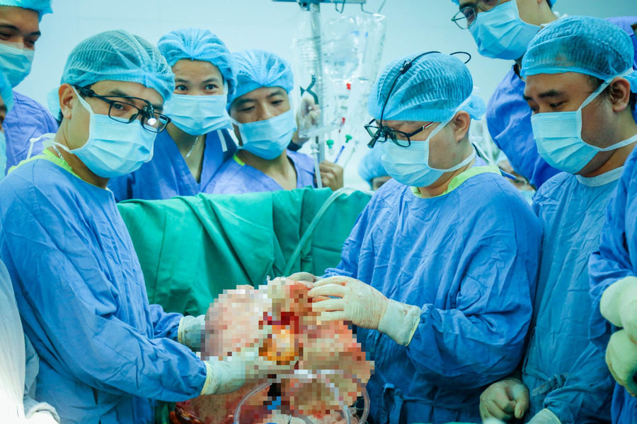 Ca phẫu thuật thành công kéo dài 7 giờ đồng hồ (Ảnh: VGP)