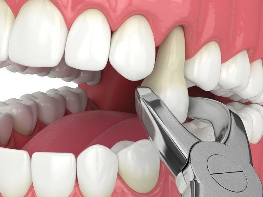 Uống thuốc giảm đau trong giai đoạn này có thể gây rối loạn tiêu hóa (Ảnh minh họa)  