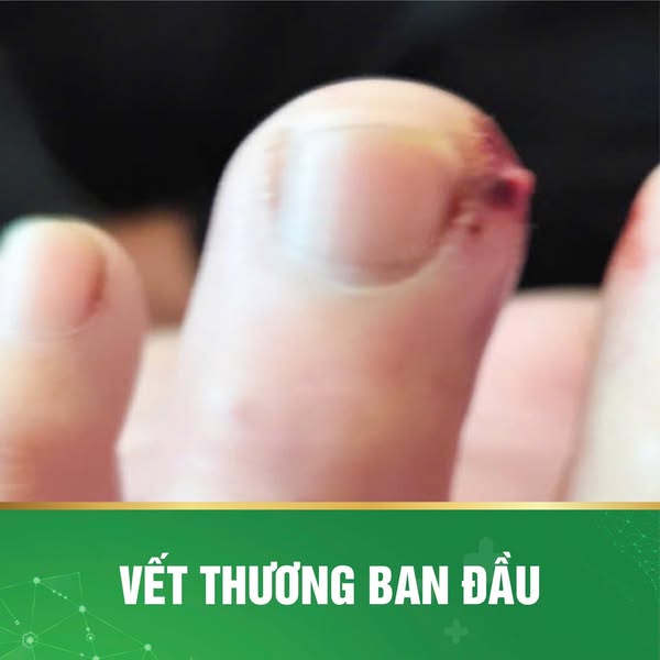 Hình ảnh vết thương ban đầu (Ảnh: BVCC)