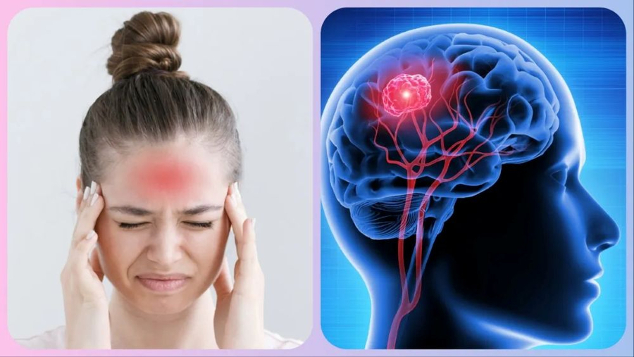 Cần bổ sung đa dạng các loại thực phẩm để phòng tránh thiếu máu não (Ảnh minh họa)  