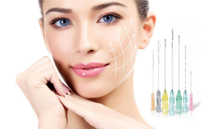 Căng da mặt bằng chỉ Collagen giúp nâng cơ, cải thiện tình trạng chảy xệ và nếp nhăn (Ảnh minh họa)