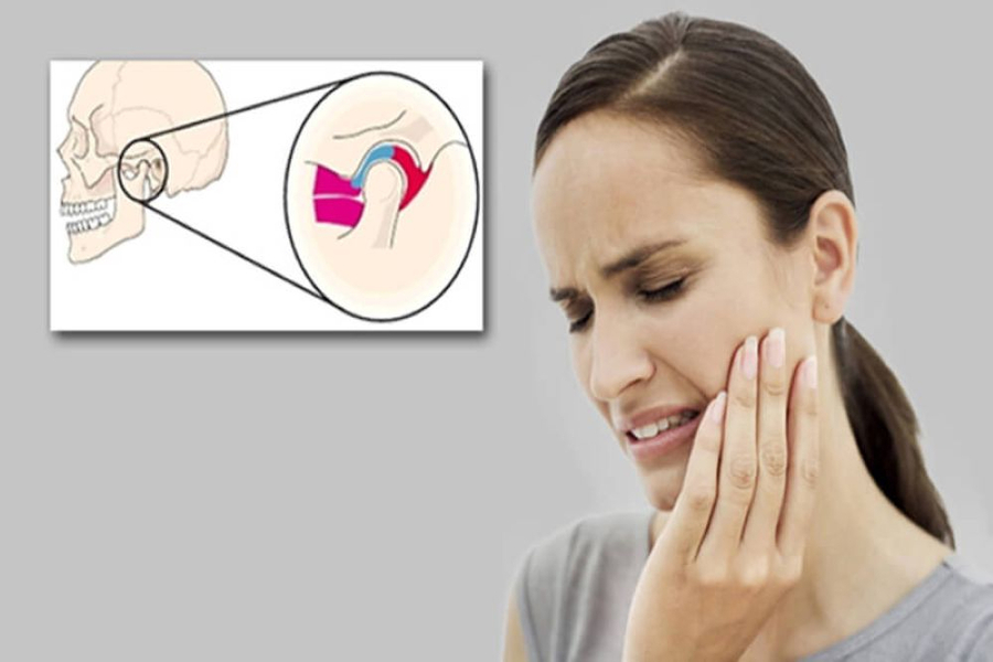 Chịu chứng của rối loạn khớp thái dương hàm dễ bị bỏ qua (Ảnh minh họa)
