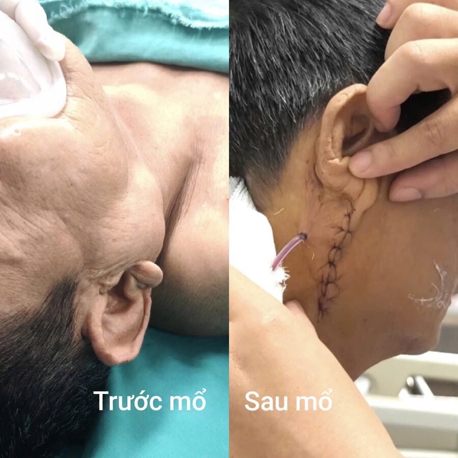 Tình trạng trước và sau phẫu thuật của bệnh nhân