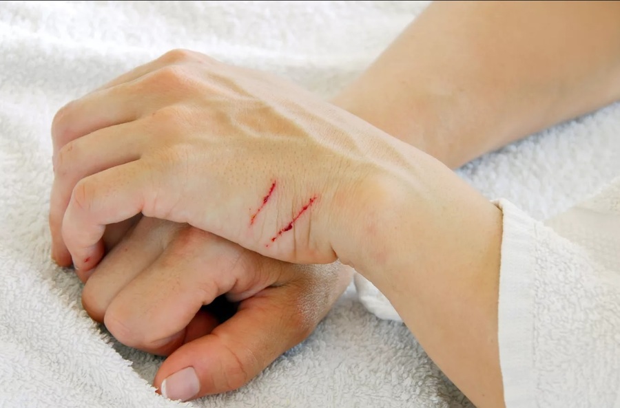 Phát kiến mới hứa hẹn thay đổi điều trị chấn thương, giảm viêm, chống nhiễm trùng và hỗ trợ hồi phục nhanh