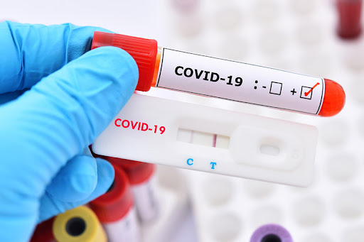 test covid