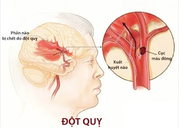 dot_quy