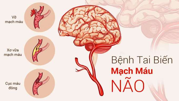 tai-bien-mach-mau-nao