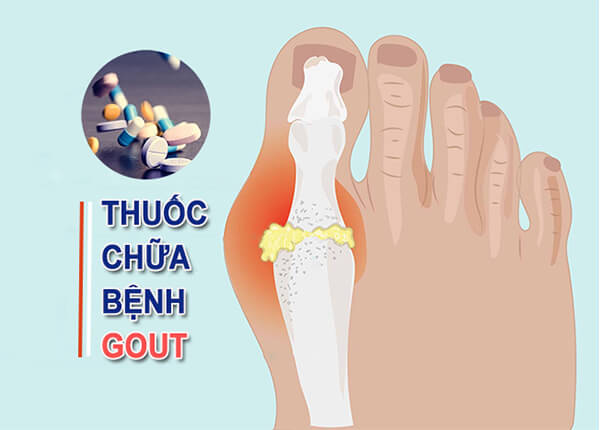 thuoc-chua-benh-gut-01