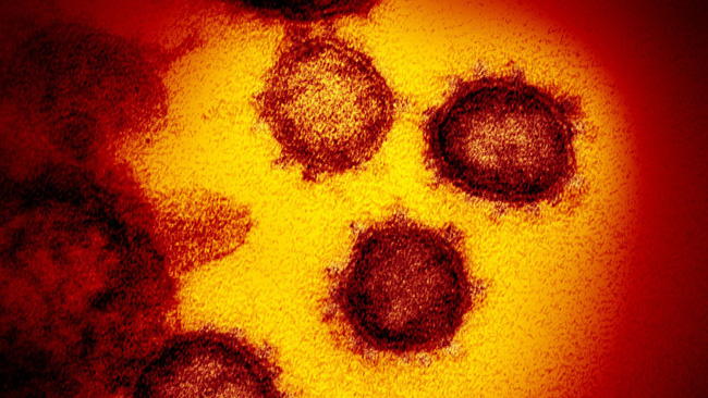 skynews-covid-19-covid-coronavirus5775209-1656748553162419403663