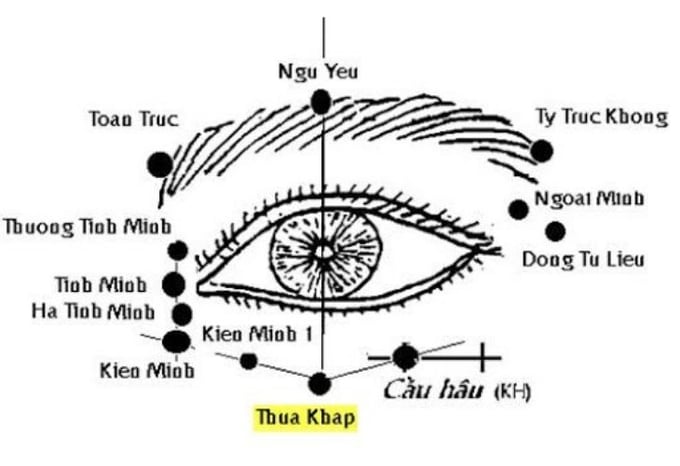 huyet-thua-khap-1
