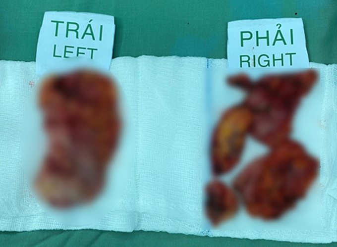 Empty