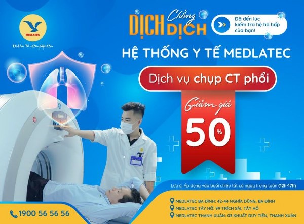 _banner-chup-ct-phoi_600x442