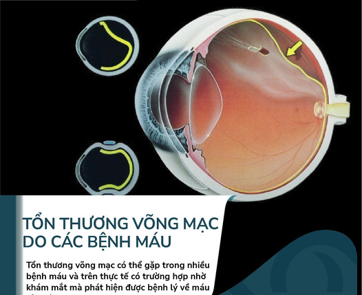 tonthuong