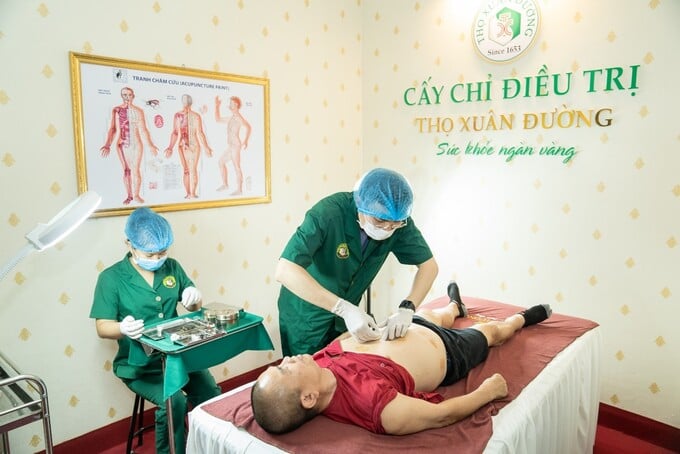 cay chi 2