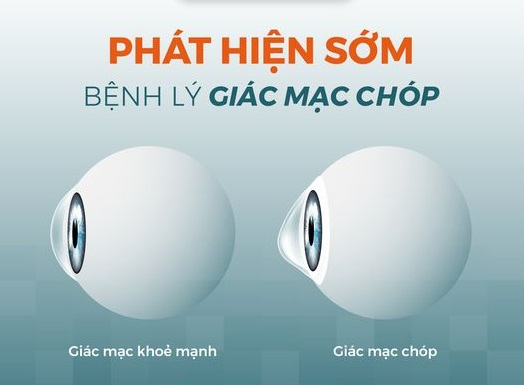 Ảnh: Bệnh Viện Mắt Hà Nội 2