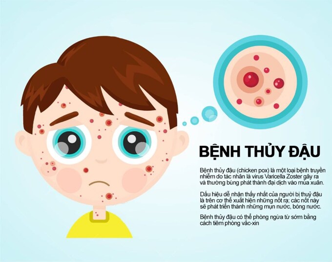 benh-thuy-dau-1