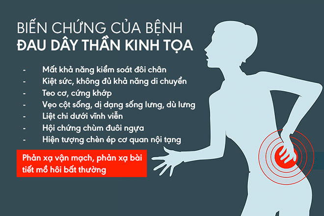 dau-than-kinh-toa-Nguyen-nhan-trieu-chung-va-cach-chua-benh-dut-diem-dau-than-kinh-toa-17-1545016299-949-width660height440