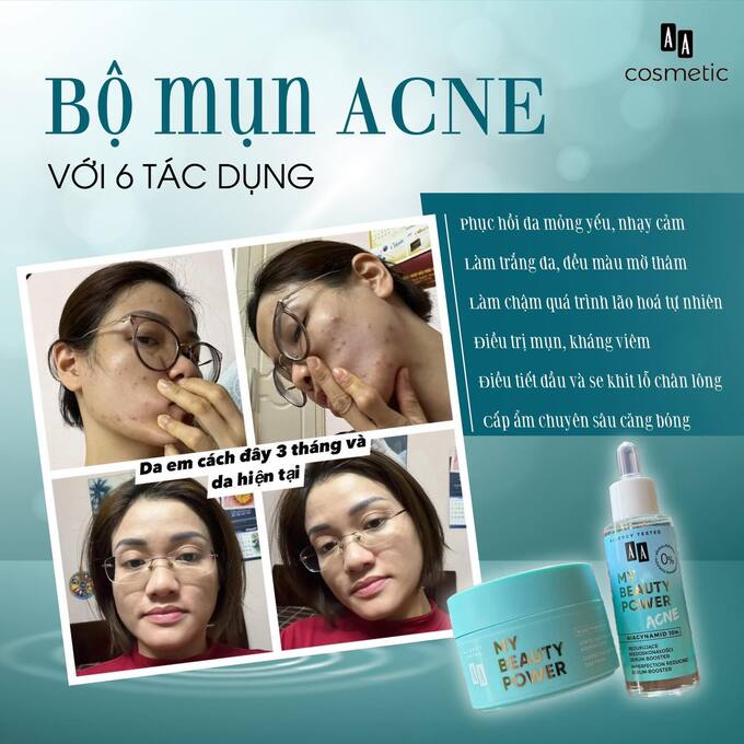 anh quang cao 1