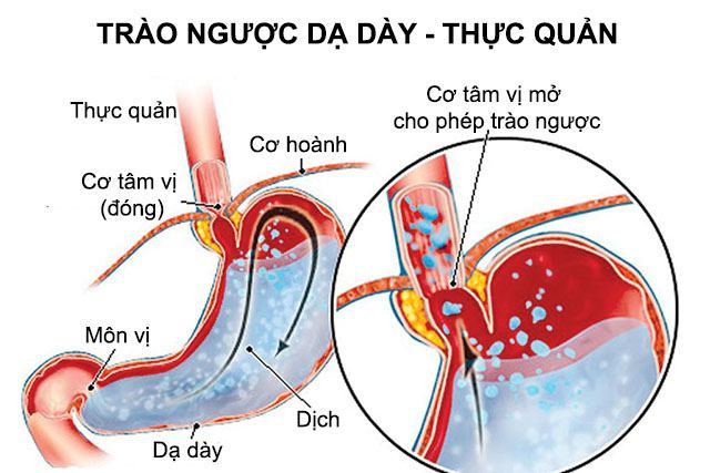 Mức độ nguy hiểm của người mắc đồng thời hai bệnh này. Ảnh: Nội khoa Việt Nam