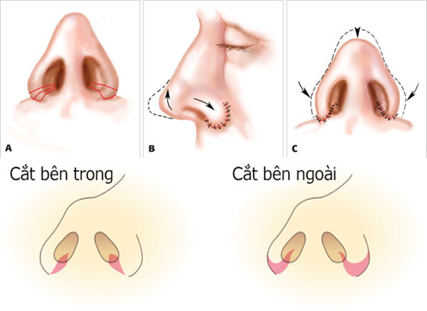 mui 1