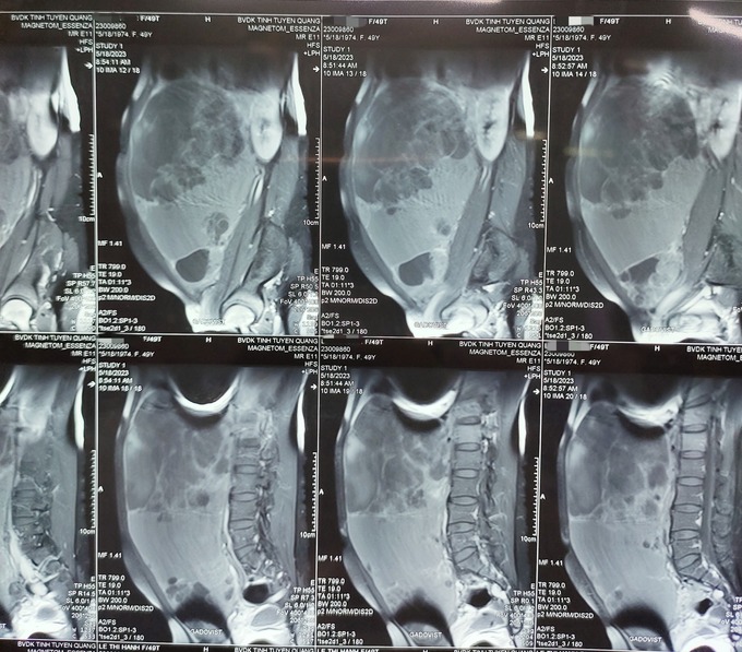 Empty