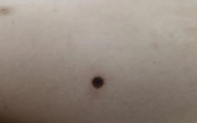 l