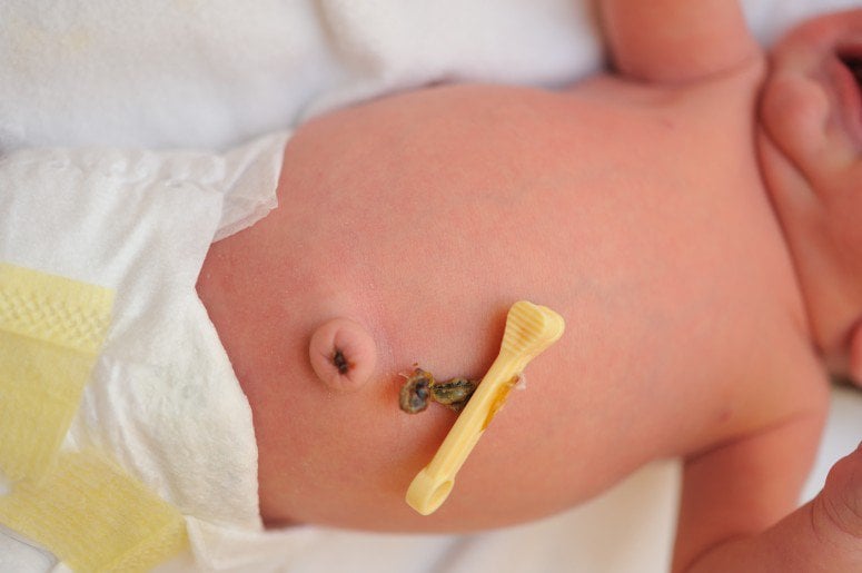 20190821_064756_186039_cordon-umbilical.max-800x800