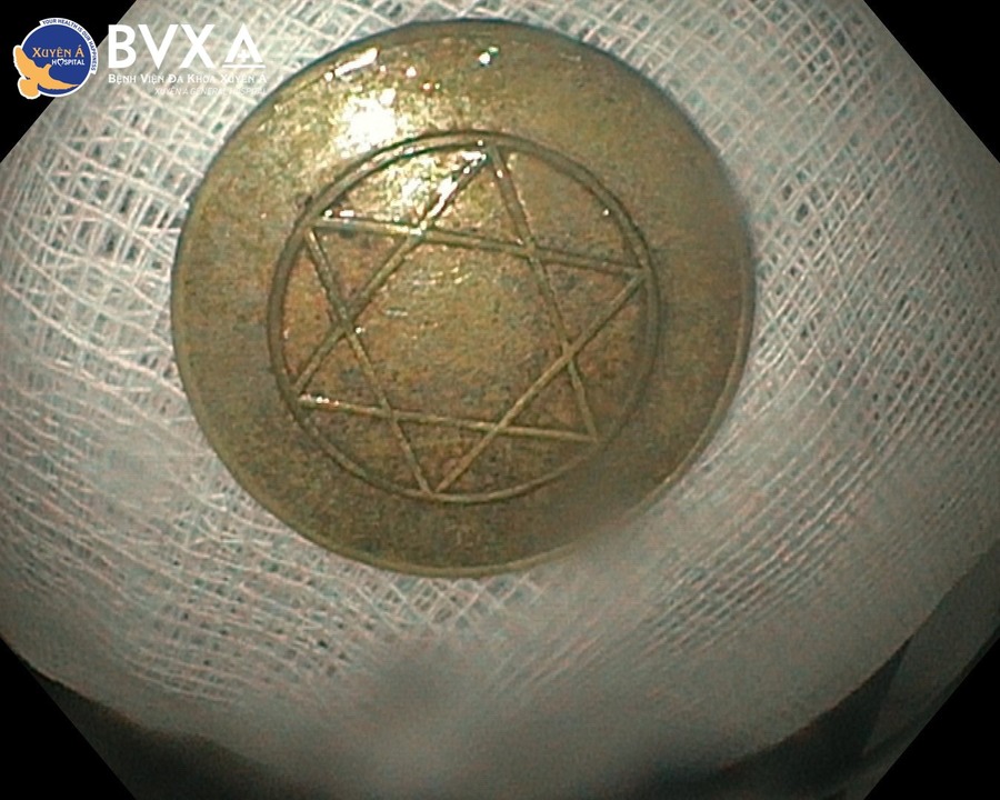 423862413_875169697735325_4461518281290705309_n