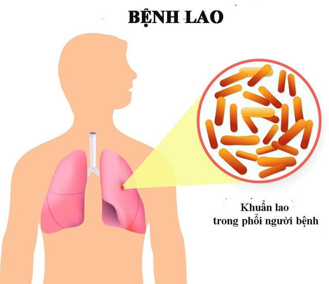 benhlao1