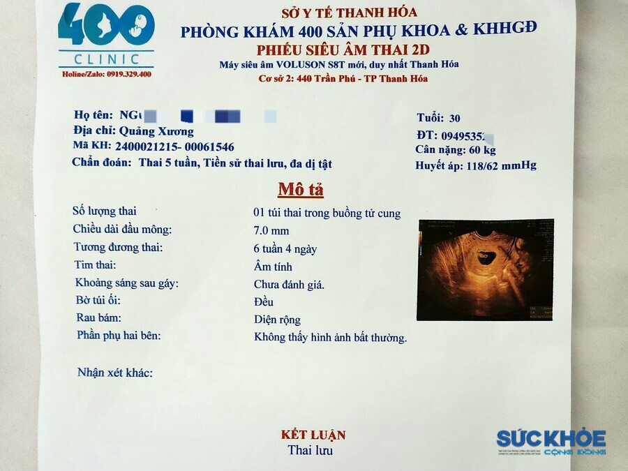 BS.CKII Lê Văn Thụ, phụ trách Phòng khám 400, cho biết kết luận 