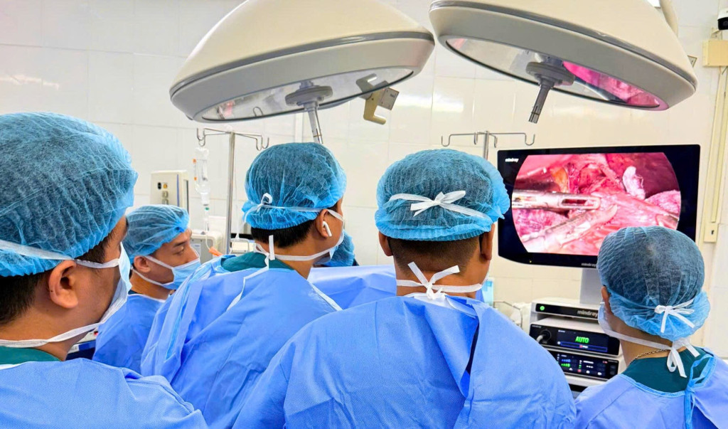 Ê-kíp phẫu thuật tiến hành mổ bằng Heller kết hợp tạo hình tâm vị theo phương pháp Dor (Ảnh: Bệnh viện Đa khoa - TP. Hồ Chí Minh)