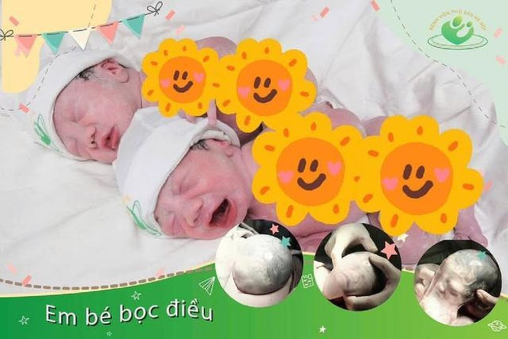 Hai bé chào đời an toàn, khỏe mạnh (Ảnh: BVCC)
