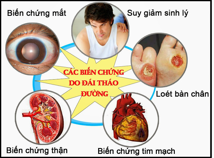 images2025983-ba-buoc-de-loai-bo-can-benh-dai-thao-duong1