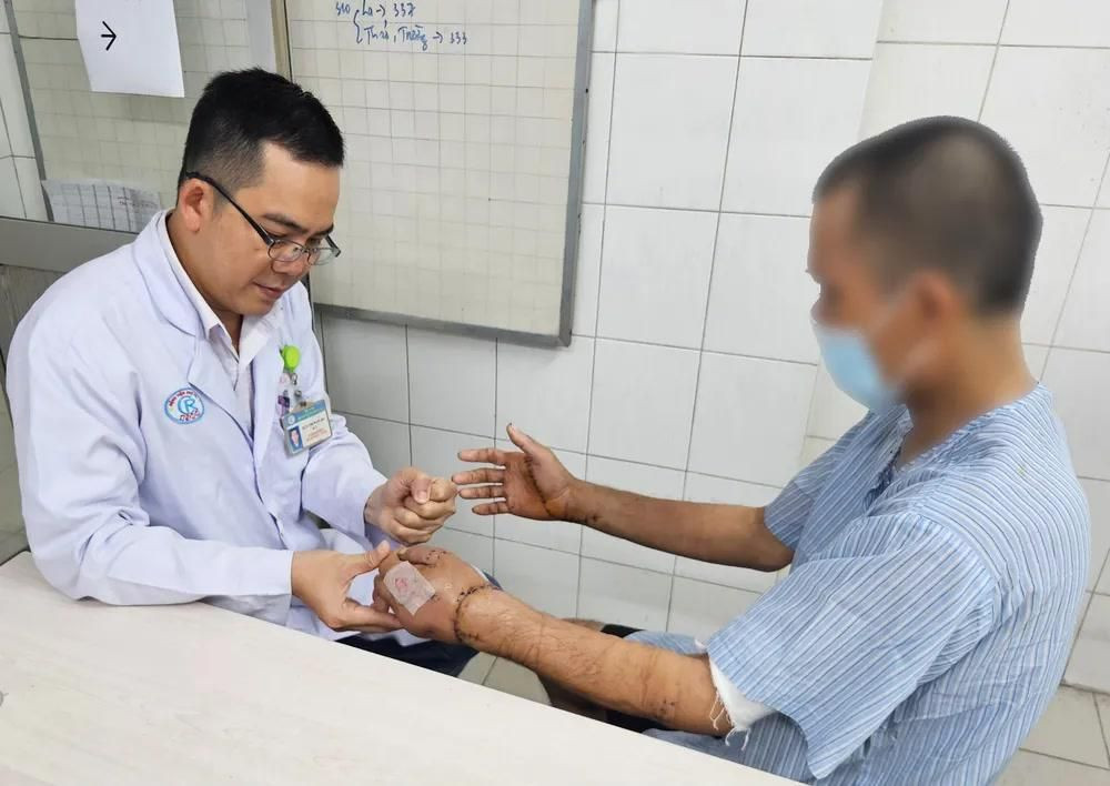 Nối chi đứt lìa bằng vi phẫu là “siêu phẫu”, đòi hỏi tay nghề cao và trang thiết bị hiện đại ( Ảnh: BVCC)
