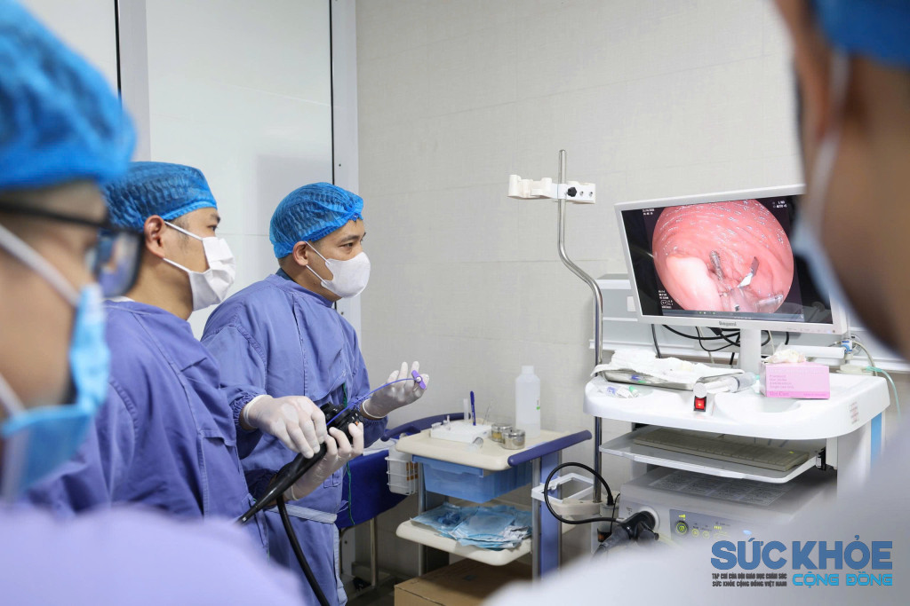Ca thủ thuật loại bỏ polyp đại tràng được đội ngũ bác sĩ tại Bệnh viện Sản Nhi tỉnh Phú Thọ thực hiện với sự hỗ trợ chuyên môn từ chuyên gia nội soi của Bệnh viện Đa khoa tỉnh Phú Thọ