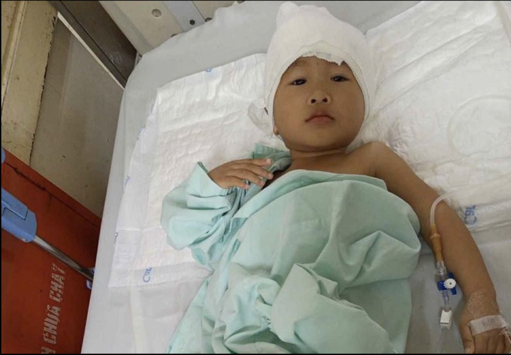 Căn bệnh quái ác đang đe dọa đến tính mạng bé Linh Đan từng ngày (Ảnh: BVCC)