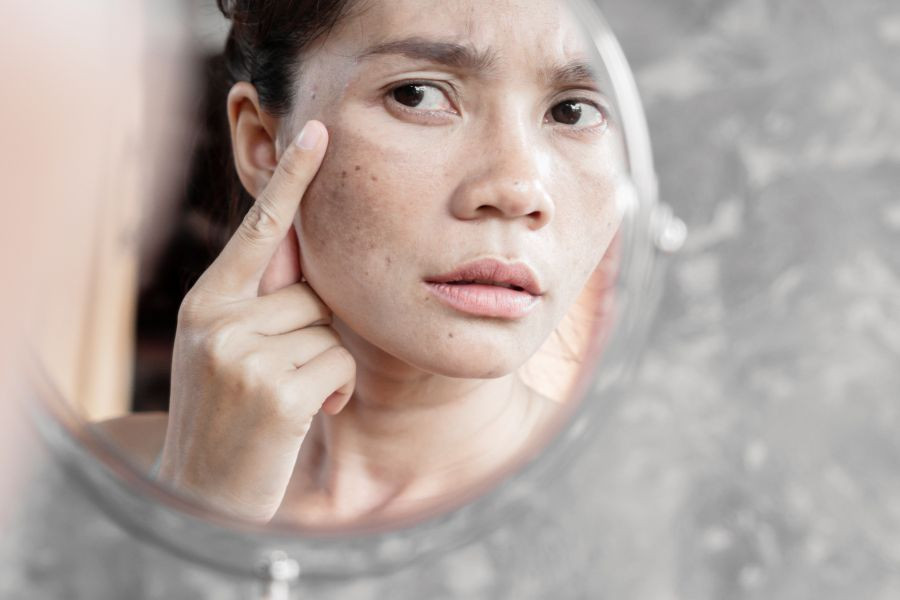 Thời tiết mùa đông hanh khô khiến da thiếu ẩm (Ảnh minh họa)