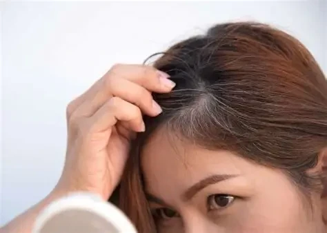 Tình trạng tóc bạc không chỉ xảy ra ở người già (Ảnh minh họa)
