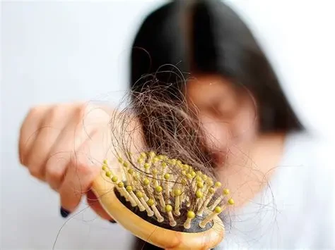 Tóc rụng nhiều là dấu hiệu của việc cơ thể đang thiếu chất sắt (Ảnh minh họa)