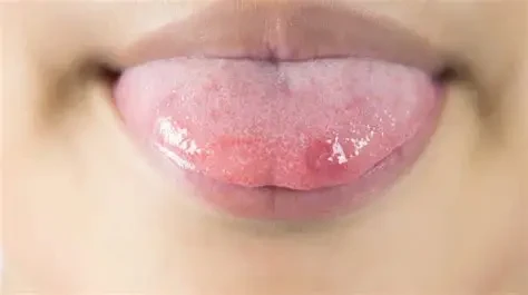Lưỡi phản ảnh tình trạng sức khỏe của cơ thể (Ảnh minh họa)