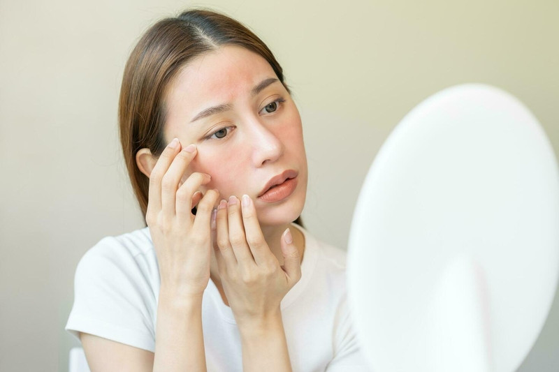 Không nên gãi khi da mặt bị ngứa (Ảnh minh họa)