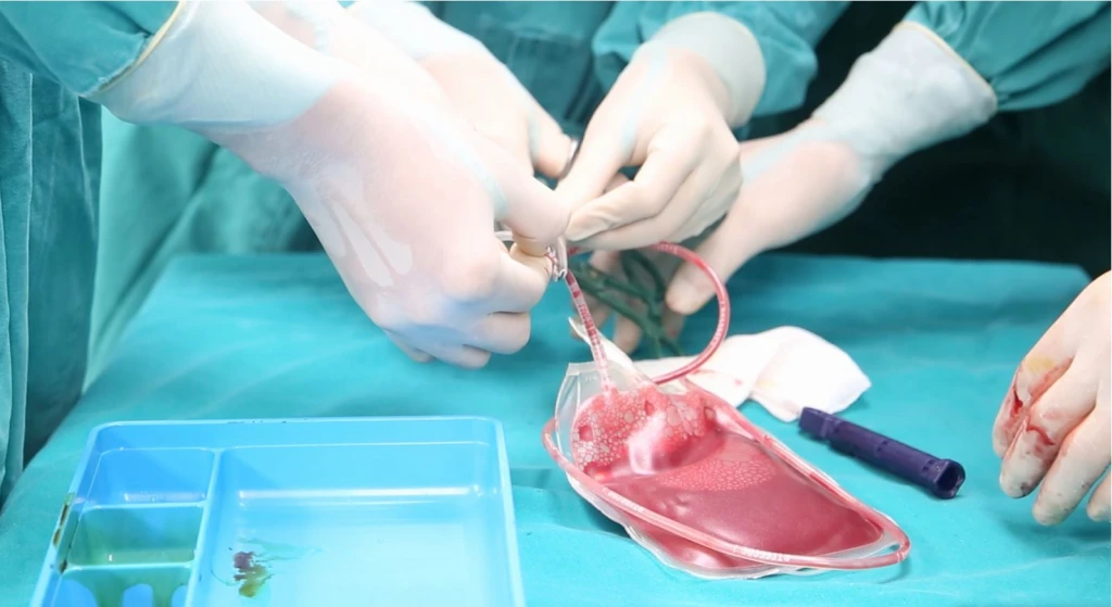 Lưu trữ tế bào gốc chủ yếu để dự phòng và điều trị nhiều bệnh hiểm nghèo trong tương lai (Ảnh minh họa)