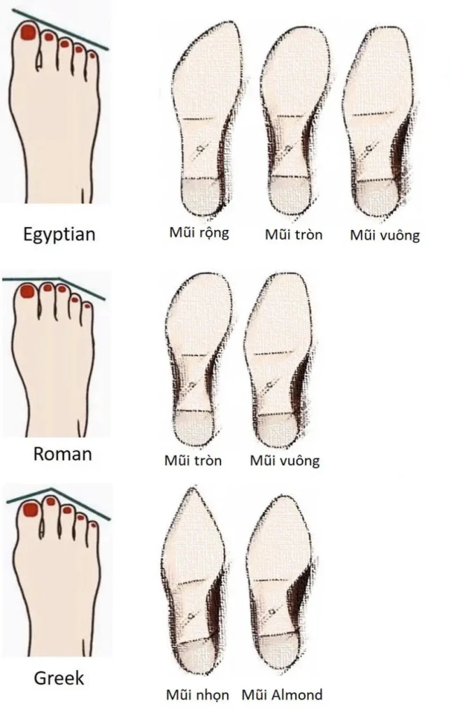 Vòm chân của mỗi người không giống nhau (Ảnh minh họa)