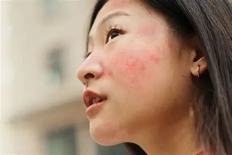 Tẩy da chết quá nhiều khiến da bị mỏng, yếu (Ảnh: Sưu tầm)