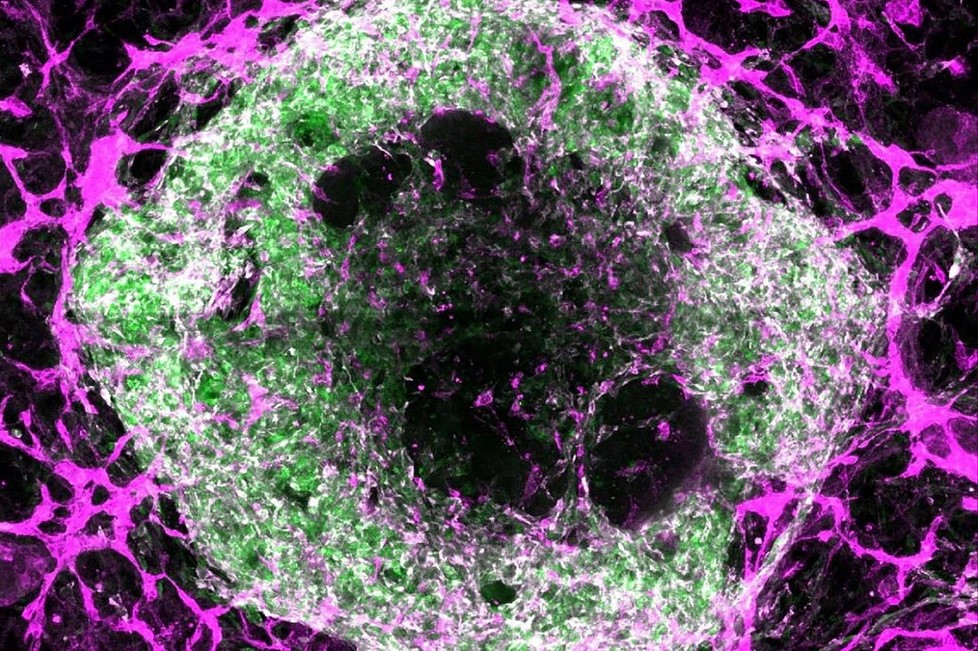 Organoid tim có mạch máu (Ảnh: Courtesy Stanford Medicine)