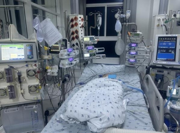 Bệnh nhi được điều trị tích cực đặt nội khí quản giúp thở (Ảnh: BVCC)