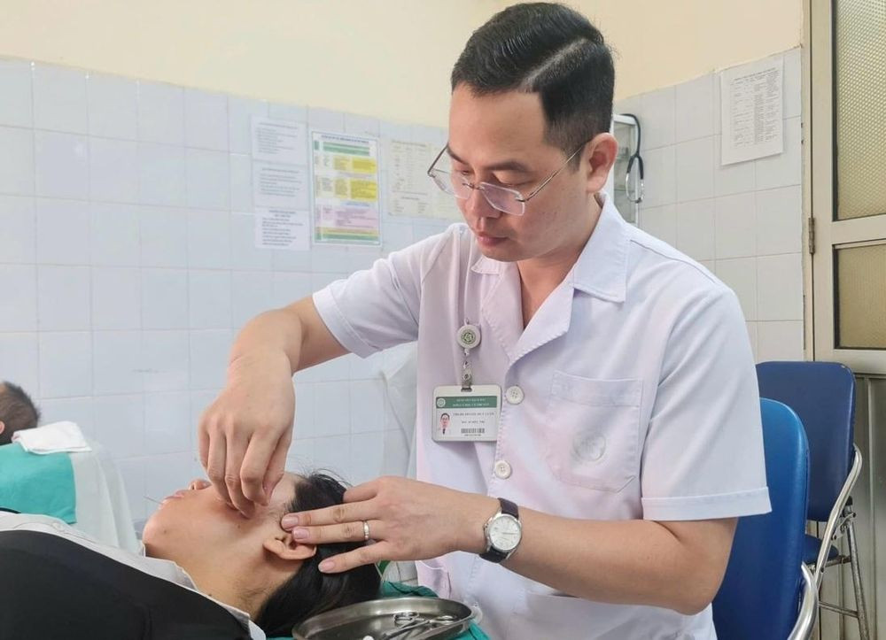 Bác sĩ châm cứu cho người bệnh liệt mặt (Ảnh: BSCC)